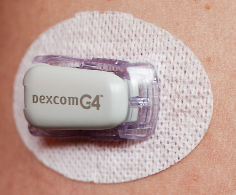 Dexcom G4 2.jpg